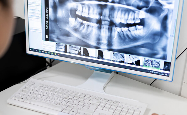 Установка импланта зуба – этапы и сроки пошагово
