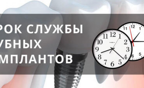Срок службы имплантов
