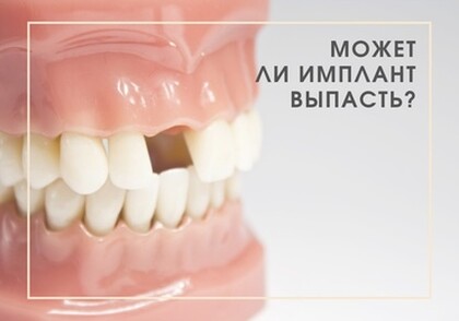 Выпадение имплантов