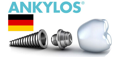 Имплантаты Ankylos