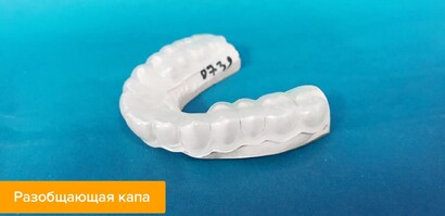 Разобщающая каппа