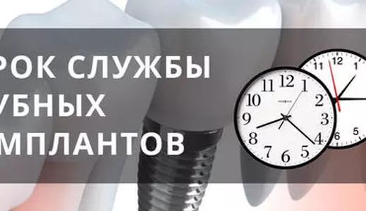 Срок службы имплантов