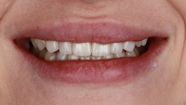 До