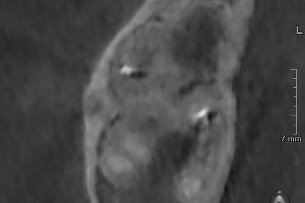После
